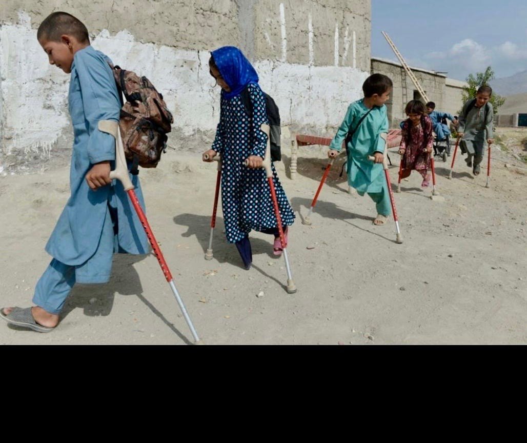 یونما: 	۱.۵ میلیون افغانستانی با ناتوانی&zwnj;های جدی زندگی می&zwnj;کنند