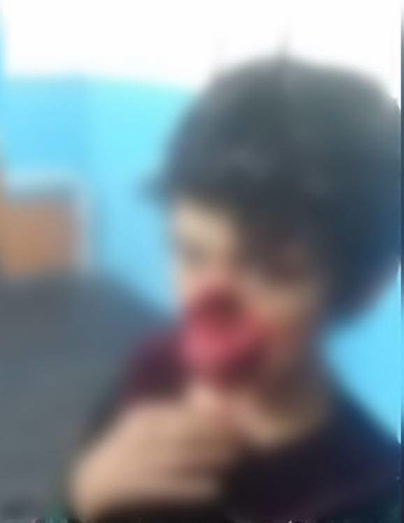 حمله دوباره موجود ناشناخته در سمنگان؛ دو کودک زخمی شدند